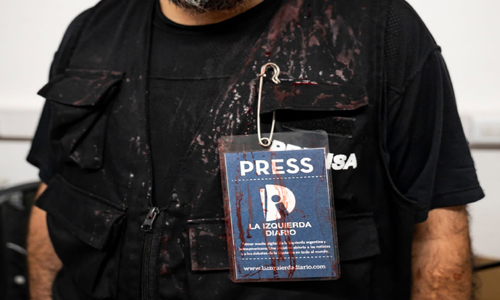 Represión policial deja a 35 periodistas heridos en Argentina