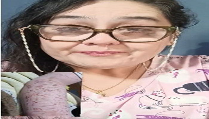 Madre denuncia acoso escolar tras detectar más de 150 autolesiones en su hijo